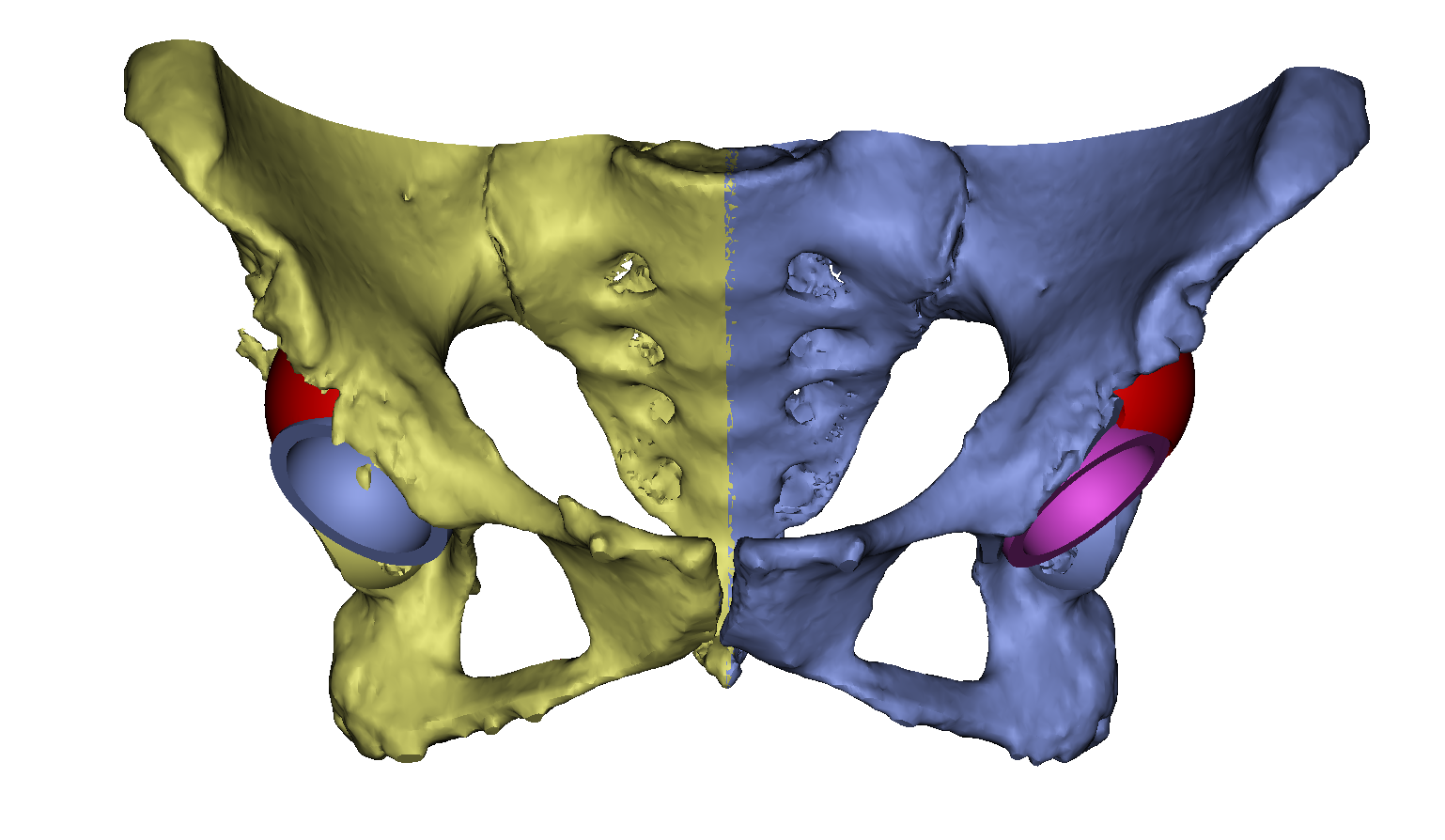 高新特急重系列报道：大姐跛行50年，做完手术不仅能正常走路了，还“长高”了5公分