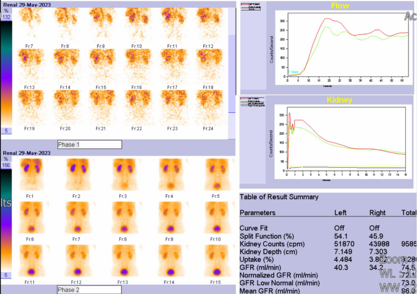就医更方便，绵阳市三医院可以做肾动态显像检查了！